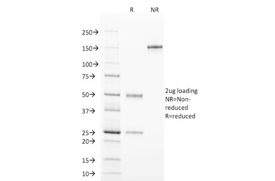 SDS-PAGE - Anti-TCL1 Antibody [TCL1/2078] - BSA and Azide free (A253576) - Antibodies.com