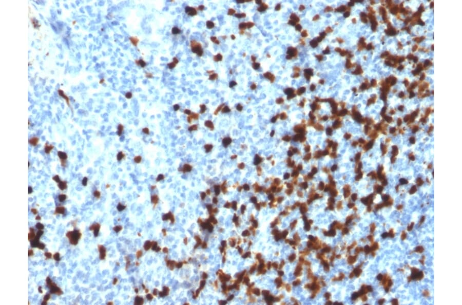 Immunohistochemistry - Anti-TCL1 Antibody [TCL1/2079] - BSA and Azide free (A253577) - Antibodies.com