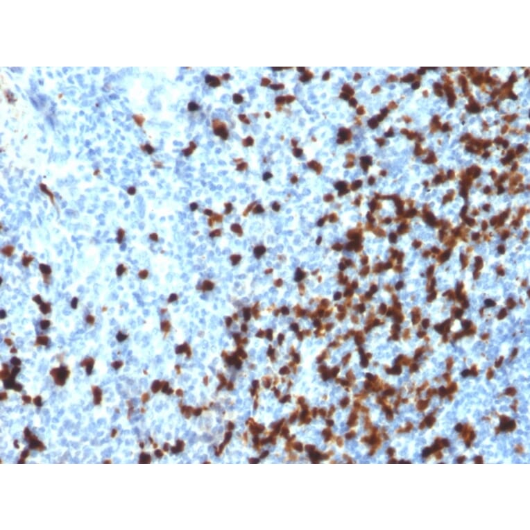 Immunohistochemistry - Anti-TCL1 Antibody [TCL1/2079] - BSA and Azide free (A253577) - Antibodies.com