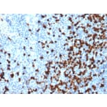 Immunohistochemistry - Anti-TCL1 Antibody [TCL1/2079] - BSA and Azide free (A253577) - Antibodies.com
