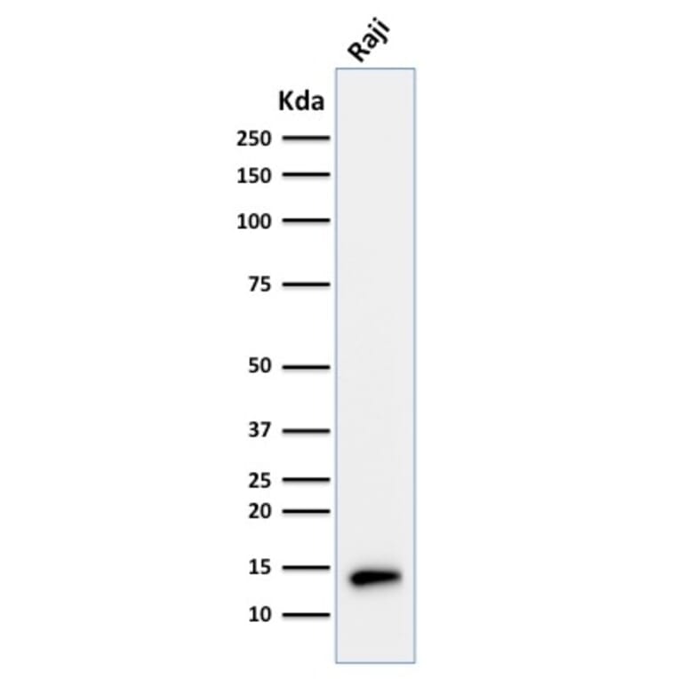 Western Blot - Anti-TCL1 Antibody [TCL1/2079] - BSA and Azide free (A253577) - Antibodies.com