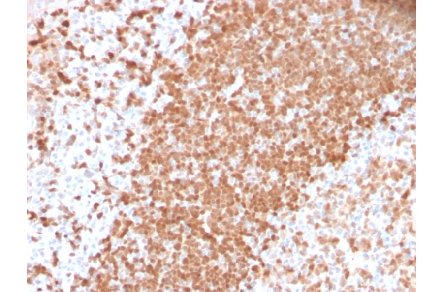Immunohistochemistry - Anti-TCL1 Antibody [TCL1/2747R] - BSA and Azide free (A253578) - Antibodies.com