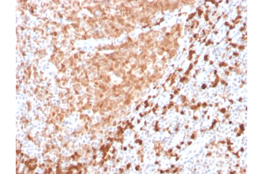 Immunohistochemistry - Anti-TCL1 Antibody [TCL1/2747R] - BSA and Azide free (A253577) - Antibodies.com