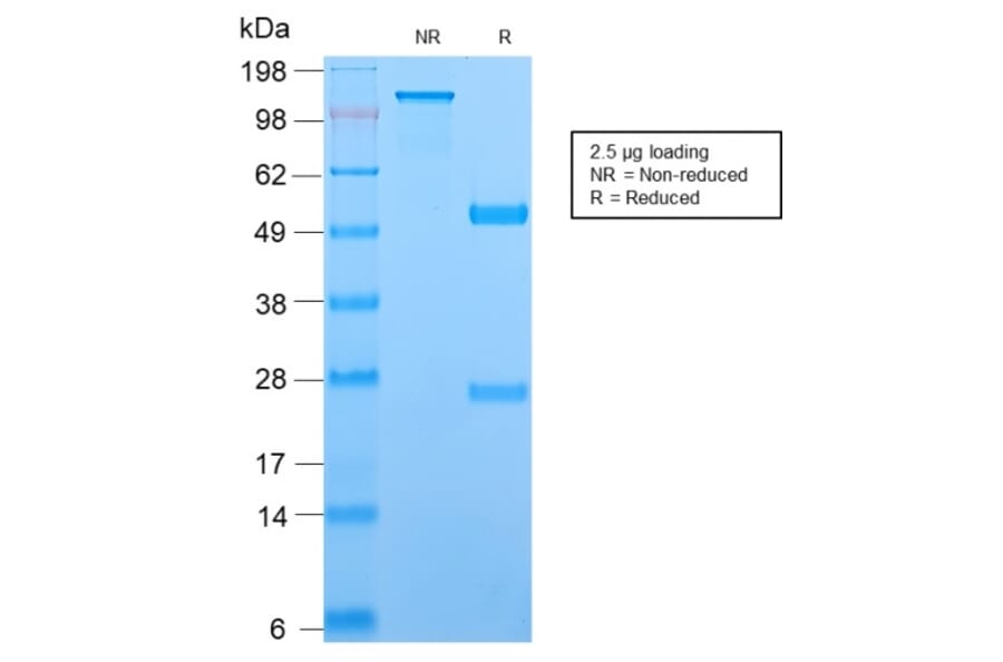SDS-PAGE - Anti-TCL1 Antibody [TCL1/2747R] - BSA and Azide free (A253578) - Antibodies.com