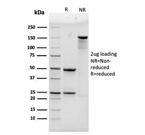 SDS-PAGE - Anti-alpha Actinin 4 Antibody [93] - BSA and Azide free (A253578) - Antibodies.com