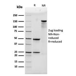 SDS-PAGE - Anti-alpha Actinin 4 Antibody [93] - BSA and Azide free (A253578) - Antibodies.com