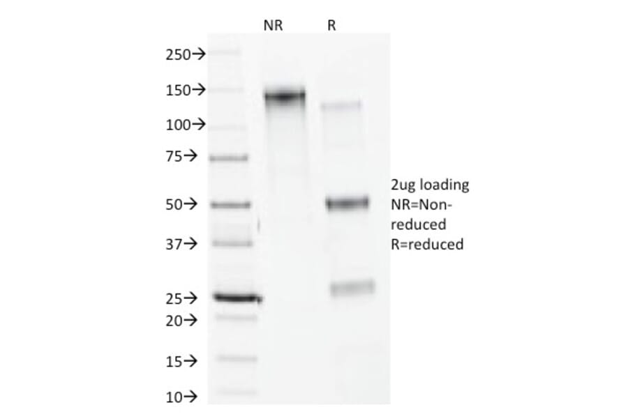 SDS-PAGE - Anti-Calnexin Antibody [CANX/1541] - BSA and Azide free (A253580) - Antibodies.com