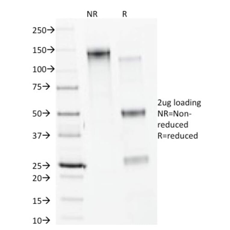 SDS-PAGE - Anti-Calnexin Antibody [CANX/1541] - BSA and Azide free (A253580) - Antibodies.com