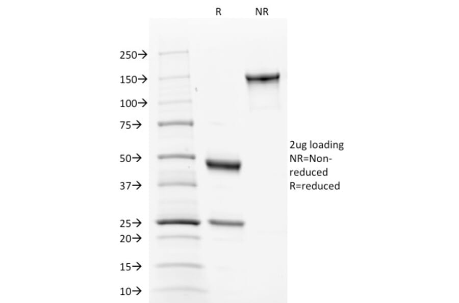 SDS-PAGE - Anti-Calnexin Antibody [CANX/1543] - BSA and Azide free (A253581) - Antibodies.com