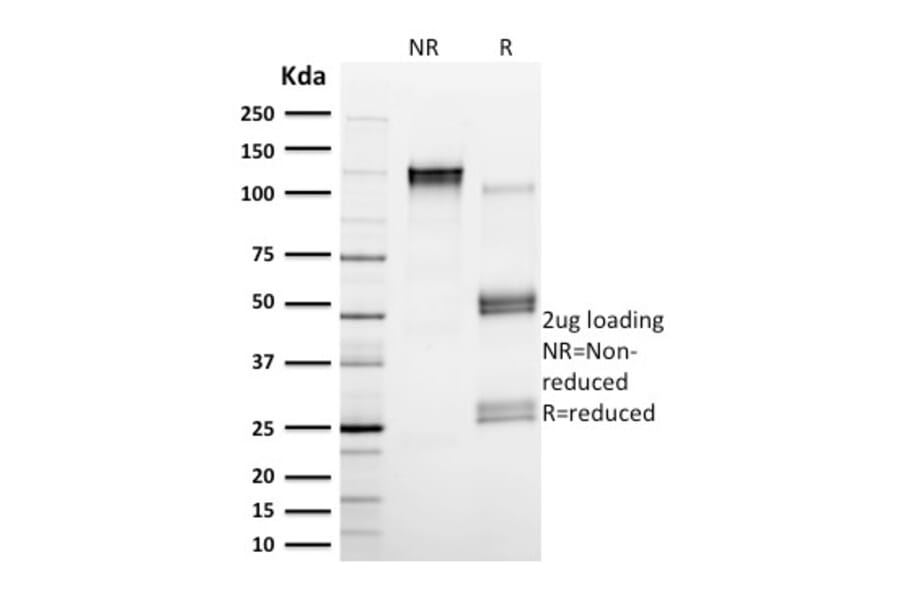 SDS-PAGE - Anti-Calpain 1 Antibody [CAPN1/1530] - BSA and Azide free (A253582) - Antibodies.com