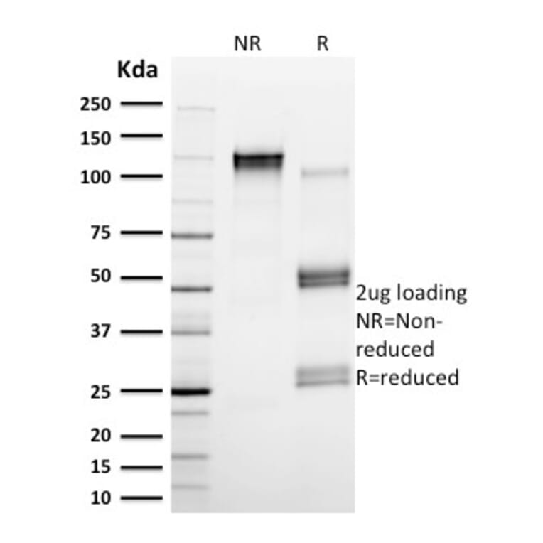 SDS-PAGE - Anti-Calpain 1 Antibody [CAPN1/1530] - BSA and Azide free (A253582) - Antibodies.com