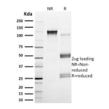 SDS-PAGE - Anti-Calpain 1 Antibody [CAPN1/1530] - BSA and Azide free (A253582) - Antibodies.com