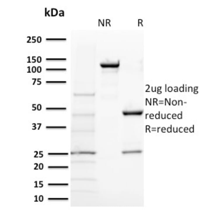 SDS-PAGE - Anti-BAP1 Antibody [BAP1/2431] - BSA and Azide free (A253587) - Antibodies.com