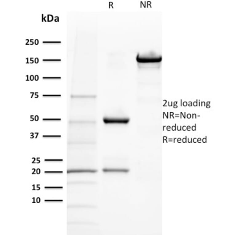 SDS-PAGE - Anti-BAP1 Antibody [BAP1/2432] - BSA and Azide free (A253588) - Antibodies.com