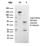 SDS-PAGE - Anti-BAP1 Antibody [BAP1/2665] - BSA and Azide free (A253590) - Antibodies.com
