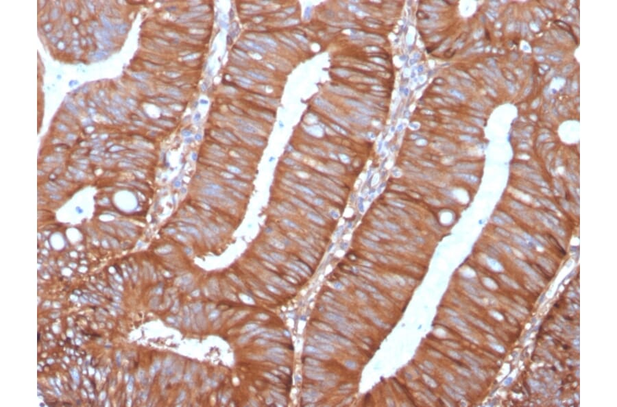 Immunohistochemistry - Anti-Calpastatin Antibody [CAST/1550] - BSA and Azide free (A253592) - Antibodies.com