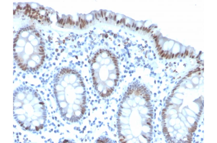 Immunohistochemistry - Anti-Histone H3 (phospho Ser10) Antibody [PHH3/471R] - BSA and Azide free (A253592) - Antibodies.com