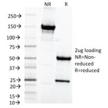 SDS-PAGE - Anti-MAML2 Antibody [MAML2/1302] - BSA and Azide free (A253596) - Antibodies.com