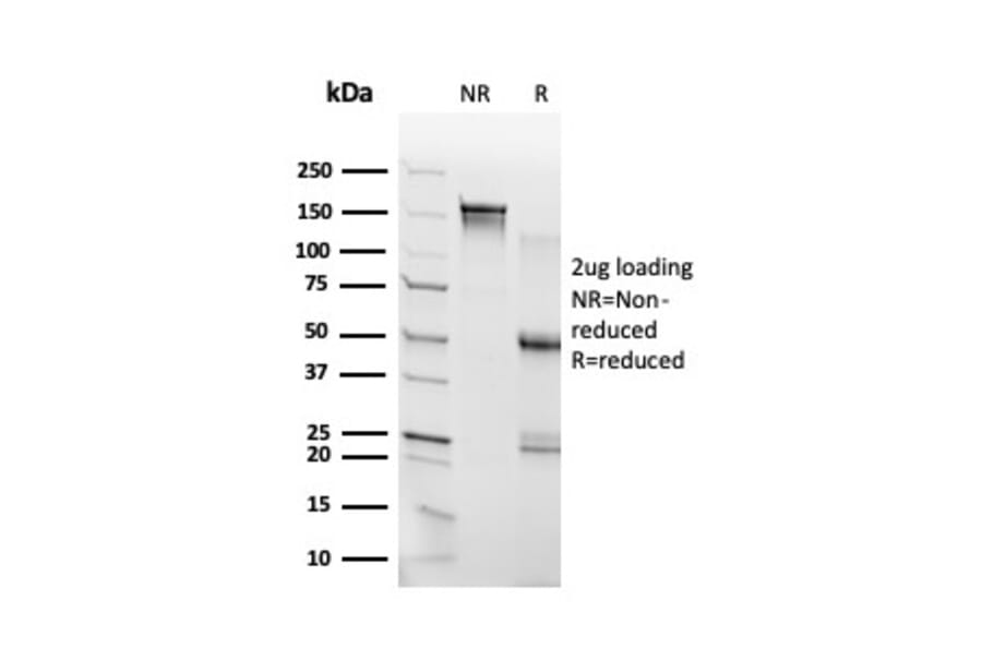 SDS-PAGE - Anti-RHOXF2 Antibody [PCRP-RHOXF2-1D7] - BSA and Azide free (A253597) - Antibodies.com