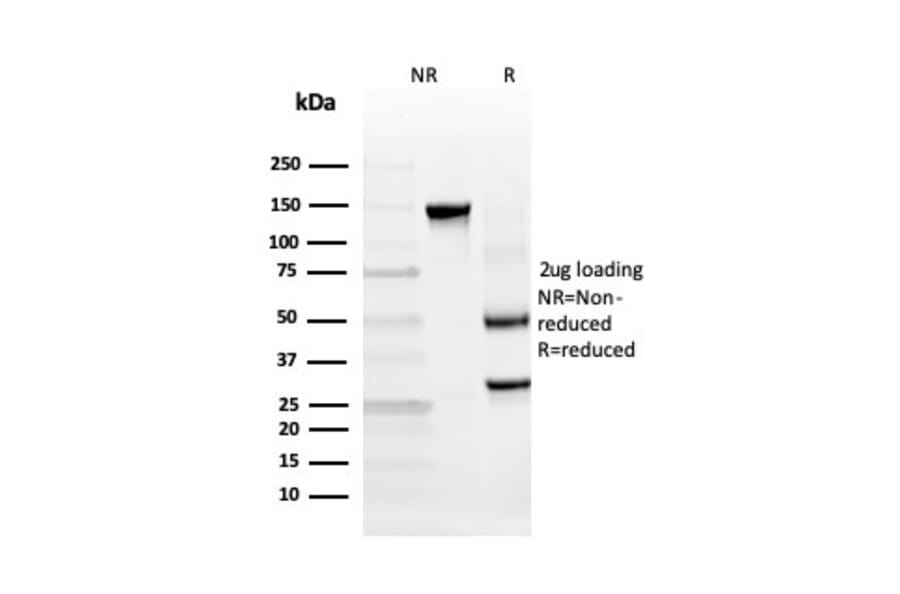 SDS-PAGE - Anti-INSM2 Antibody [INSM2/4291] - BSA and Azide free (A253598) - Antibodies.com