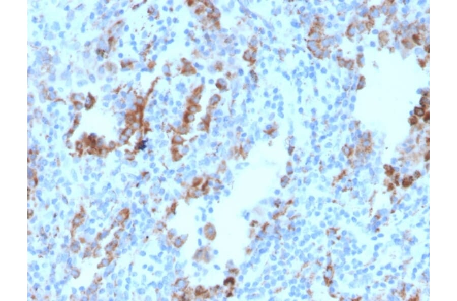 Immunohistochemistry - Anti-TIM3 Antibody [TIM3/4030] - BSA and Azide free (A253599) - Antibodies.com