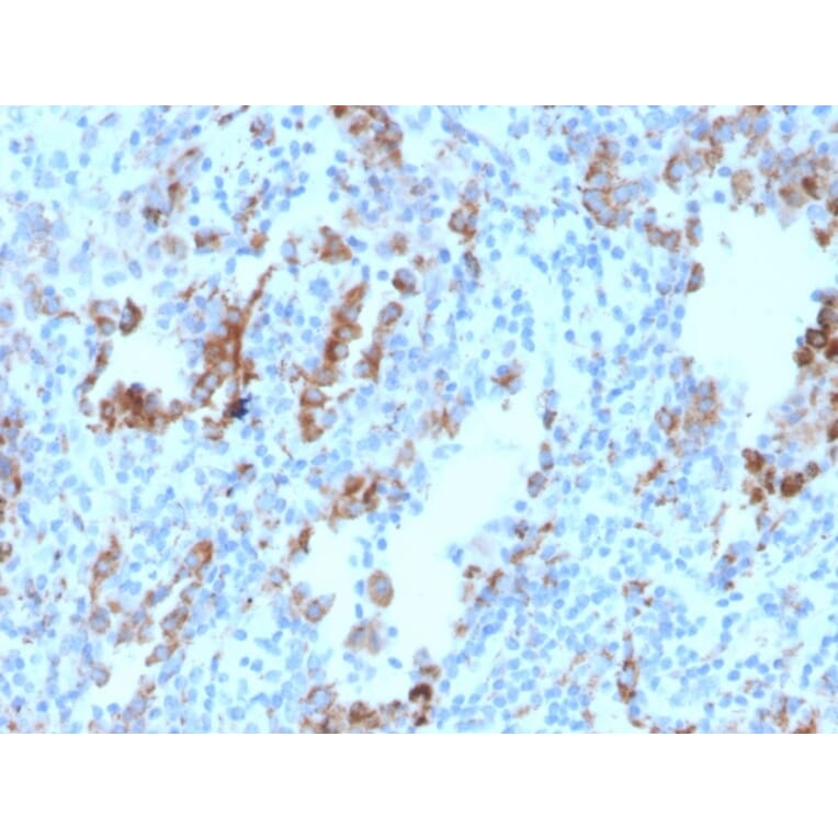 Immunohistochemistry - Anti-TIM3 Antibody [TIM3/4030] - BSA and Azide free (A253599) - Antibodies.com