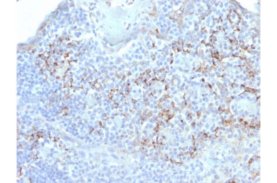 Immunohistochemistry - Anti-TIM3 Antibody [TIM3/4031] - BSA and Azide free (A253600) - Antibodies.com