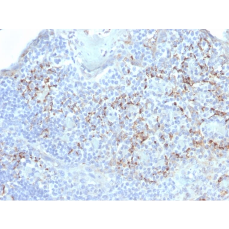 Immunohistochemistry - Anti-TIM3 Antibody [TIM3/4031] - BSA and Azide free (A253600) - Antibodies.com