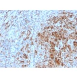 Immunohistochemistry - Anti-TIM3 Antibody [TIM3/4031] - BSA and Azide free (A253600) - Antibodies.com