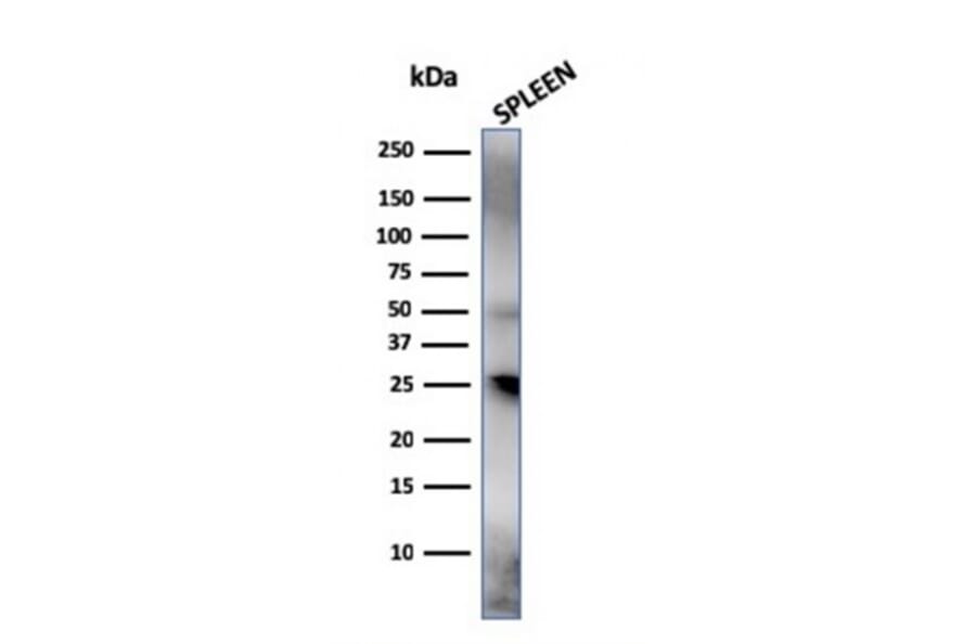 Western Blot - Anti-TIM3 Antibody [TIM3/4031] - BSA and Azide free (A253600) - Antibodies.com