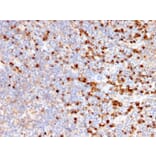 Immunohistochemistry - Anti-TIM3 Antibody [TIM3/2399] - BSA and Azide free (A253601) - Antibodies.com