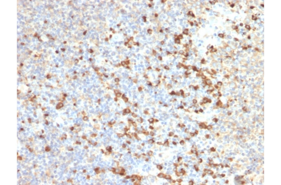 Immunohistochemistry - Anti-TIM3 Antibody [TIM3/2399] - BSA and Azide free (A253600) - Antibodies.com