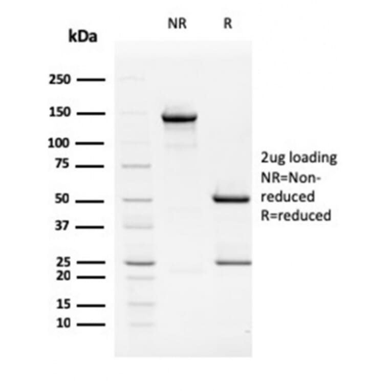 SDS-PAGE - Anti-TIM3 Antibody [TIM3/2399] - BSA and Azide free (A253601) - Antibodies.com