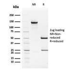 SDS-PAGE - Anti-TIM3 Antibody [TIM3/2399] - BSA and Azide free (A253601) - Antibodies.com