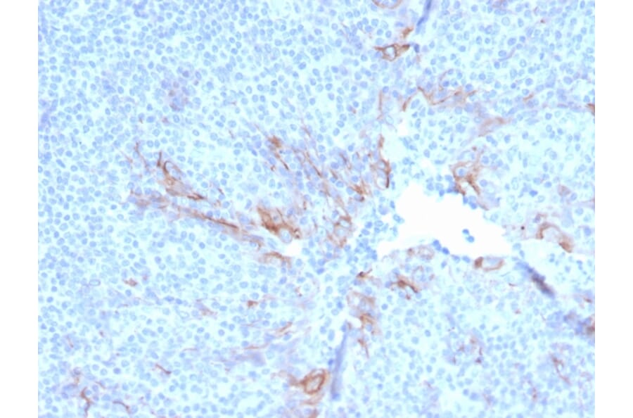 Immunohistochemistry - Anti-TIM3 Antibody [TIM3/3113] - BSA and Azide free (A253602) - Antibodies.com