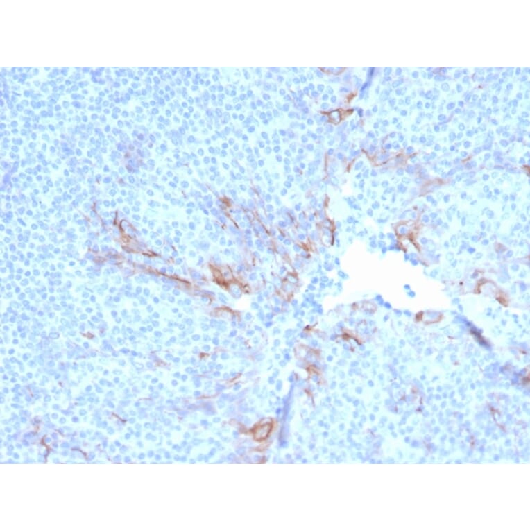 Immunohistochemistry - Anti-TIM3 Antibody [TIM3/3113] - BSA and Azide free (A253602) - Antibodies.com