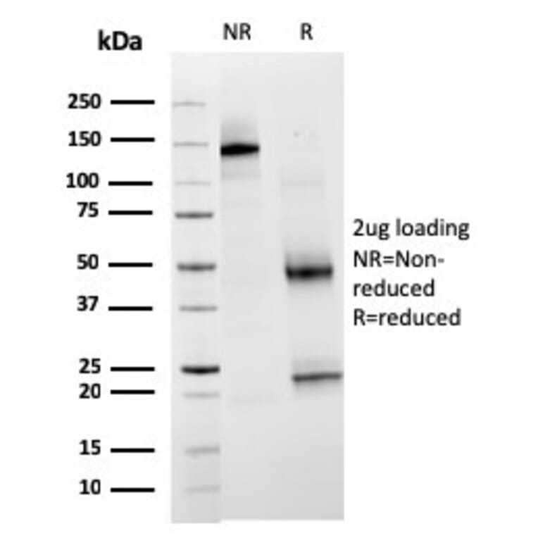 SDS-PAGE - Anti-TIM3 Antibody [TIM3/3113] - BSA and Azide free (A253602) - Antibodies.com