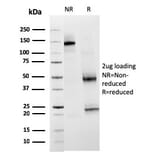 SDS-PAGE - Anti-TIM3 Antibody [TIM3/3113] - BSA and Azide free (A253602) - Antibodies.com