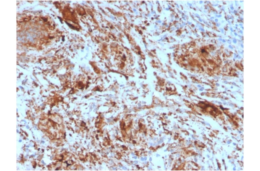 Immunohistochemistry - Anti-TIM3 Antibody [TIM3/4025] - BSA and Azide free (A253603) - Antibodies.com