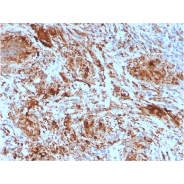 Immunohistochemistry - Anti-TIM3 Antibody [TIM3/4025] - BSA and Azide free (A253603) - Antibodies.com