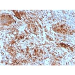 Immunohistochemistry - Anti-TIM3 Antibody [TIM3/4025] - BSA and Azide free (A253603) - Antibodies.com