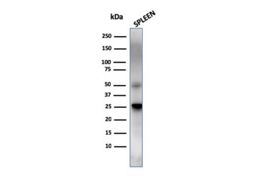 Western Blot - Anti-TIM3 Antibody [TIM3/4025] - BSA and Azide free (A253603) - Antibodies.com