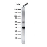 Western Blot - Anti-TIM3 Antibody [TIM3/4025] - BSA and Azide free (A253603) - Antibodies.com