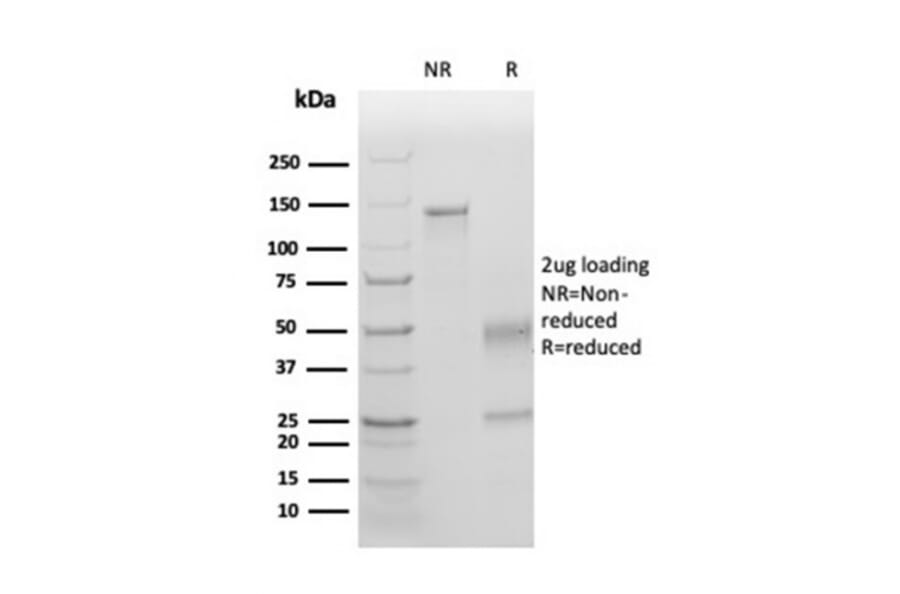 SDS-PAGE - Anti-TIM3 Antibody [TIM3/4025] - BSA and Azide free (A253603) - Antibodies.com