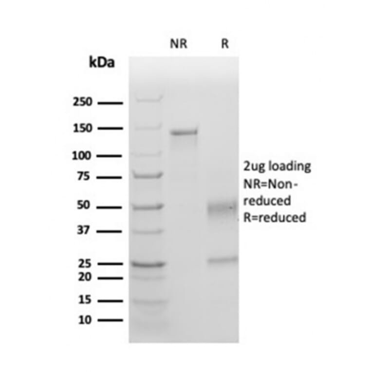 SDS-PAGE - Anti-TIM3 Antibody [TIM3/4025] - BSA and Azide free (A253603) - Antibodies.com