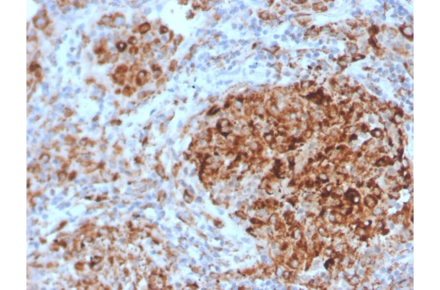 Immunohistochemistry - Anti-TIM3 Antibody [TIM3/4028] - BSA and Azide free (A253604) - Antibodies.com