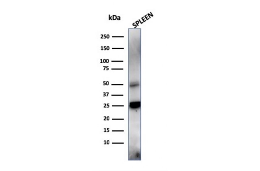 Western Blot - Anti-TIM3 Antibody [TIM3/4028] - BSA and Azide free (A253604) - Antibodies.com
