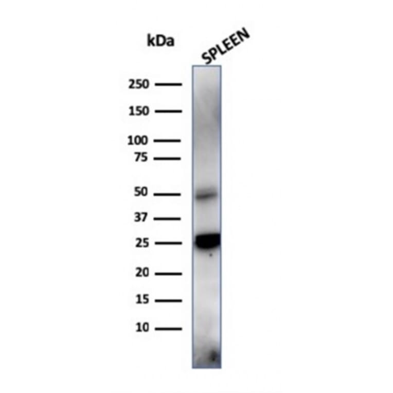 Western Blot - Anti-TIM3 Antibody [TIM3/4028] - BSA and Azide free (A253604) - Antibodies.com