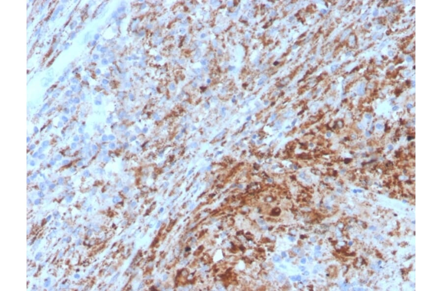 Immunohistochemistry - Anti-TIM3 Antibody [TIM3/4029] - BSA and Azide free (A253605) - Antibodies.com
