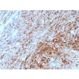 Immunohistochemistry - Anti-TIM3 Antibody [TIM3/4029] - BSA and Azide free (A253605) - Antibodies.com